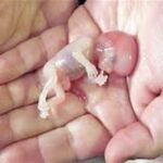 صدور کیفرخواست برای 9 متهم پرونده سقط جنین غیرقانونی در گلستان