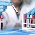 فعالیت ۴۱ آزمایشگاه تشخیص طبی در همدان